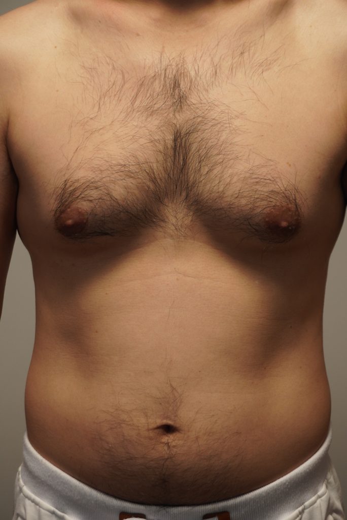 胸毛