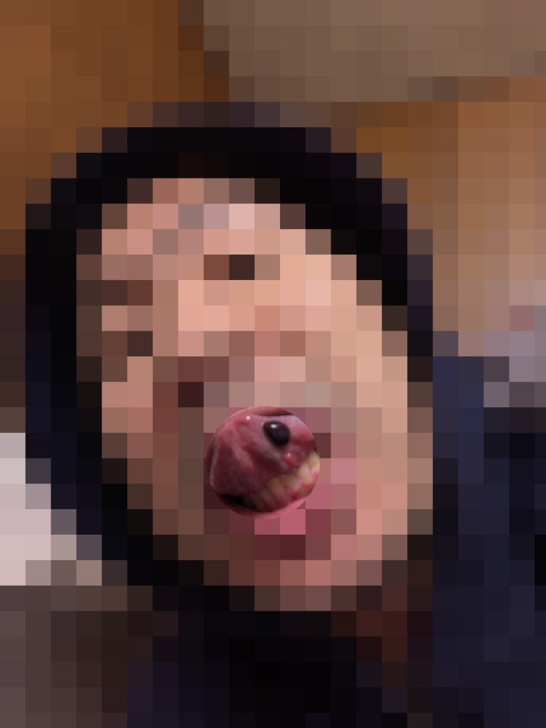 口の中に血豆が出来た。口腔内血疱